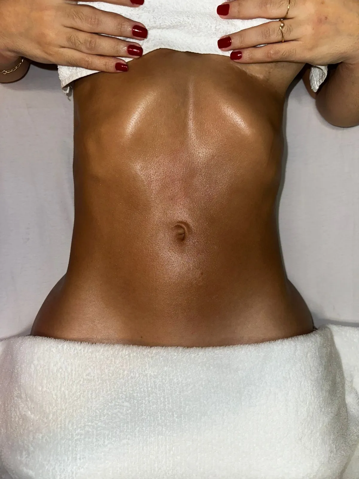 Resultado de sessão de drenagem linfática — abdômen definido